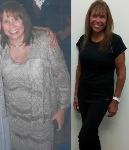 Linda Kanter Before After Photo