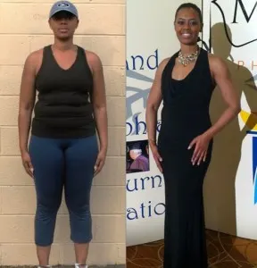 Rhonda Young Before After